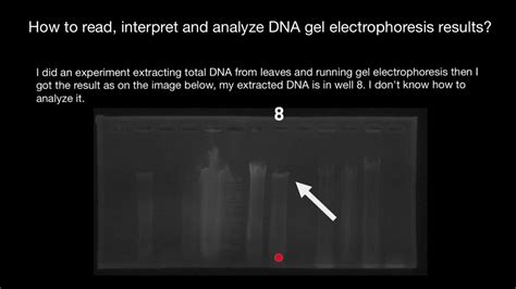 interpretation of dna gel electrophoresis results